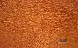2 - Cellule corticali in visione superficiale